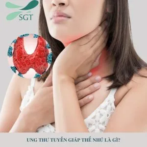 Ung thư tuyến giáp thể nhú