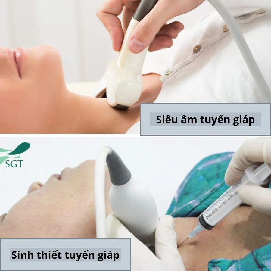 sieu am, sinh thiet