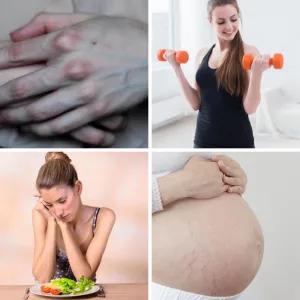 Một số nguyên nhân điển hình