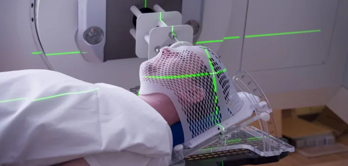 59676_radiation-therapy-head-iStock-108329640.jpg_10aa1000-329e-4757-a820-b739343d0668