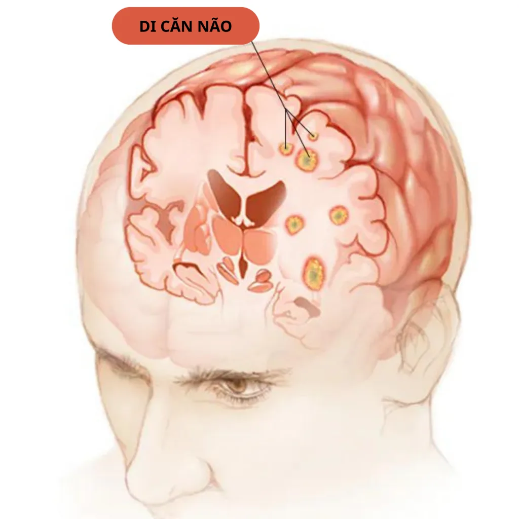 DI CĂN NÃO