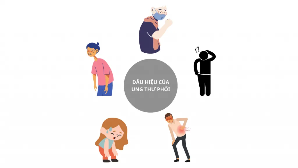DẤU HIỆU CỦA UNG THƯ PHỔI
