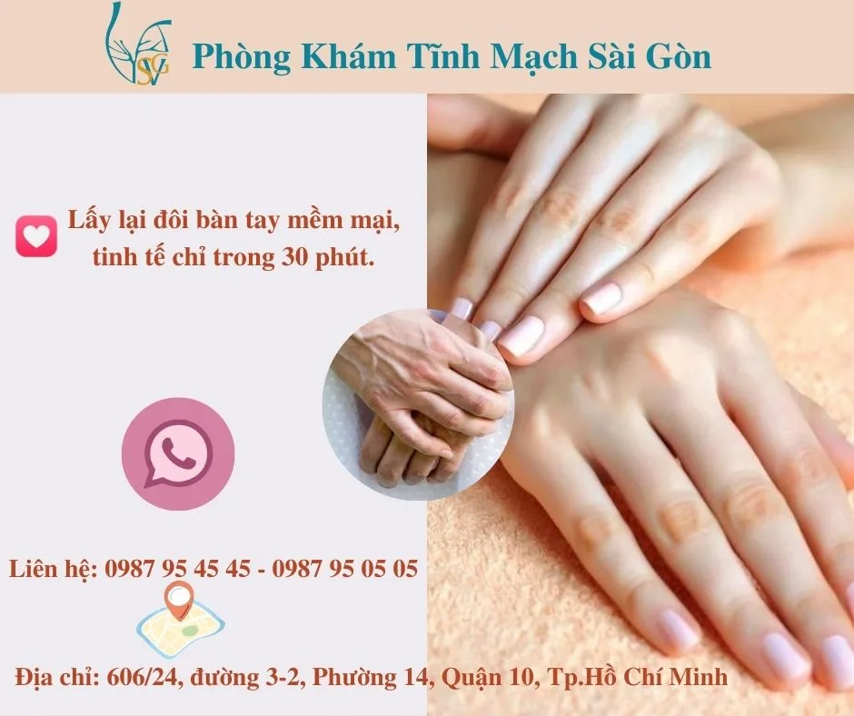 Vì sao các tĩnh mạch tay lại bị nổi phồng lên?