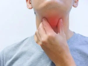 Sưng cổ, nổi hạch 