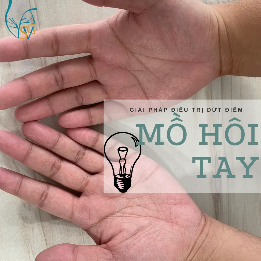 Giaỉ pháp Trị dứt điểm bệnh đổ mồ hôi tay