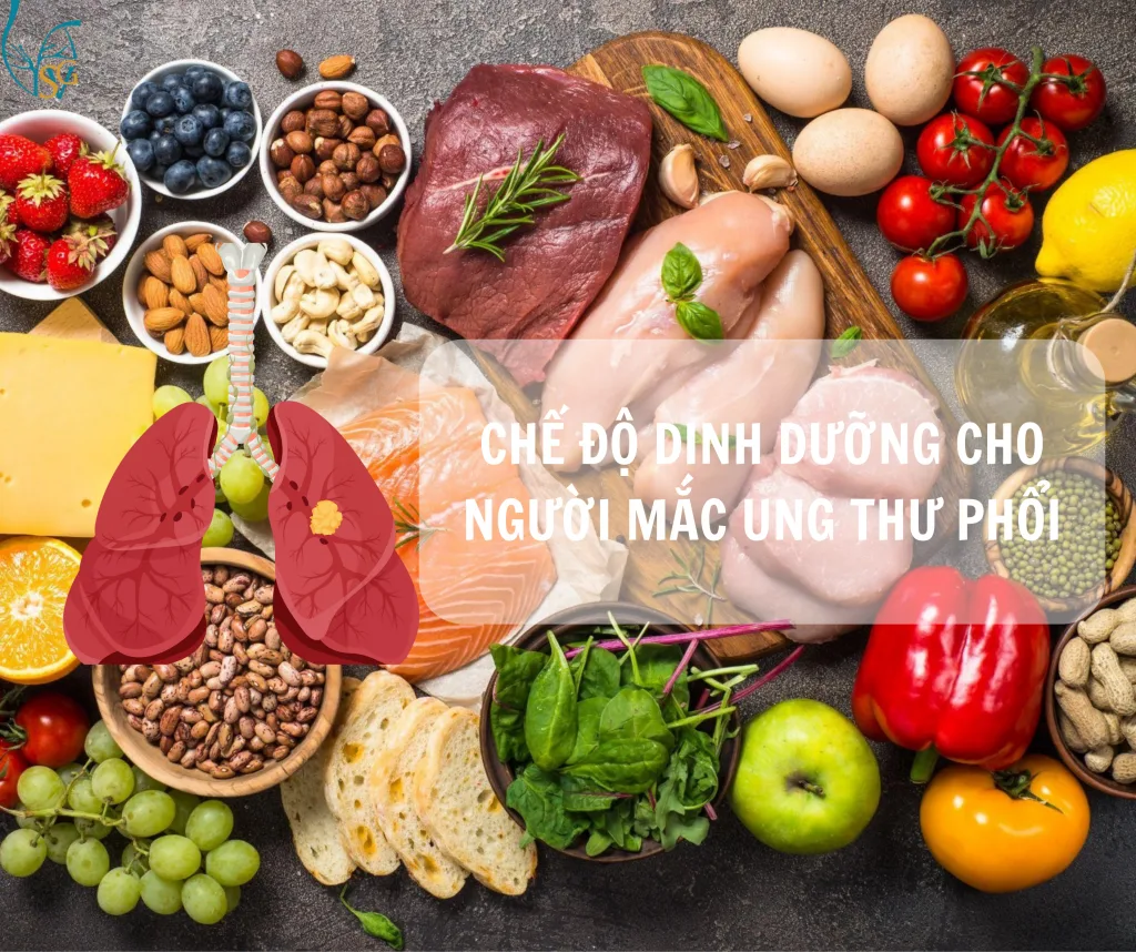 Nhiều Màu Sắc Giảm Giá Khai Trương Nhà Hàng Ẩm Thực, Bài Đăng Facebook (1)