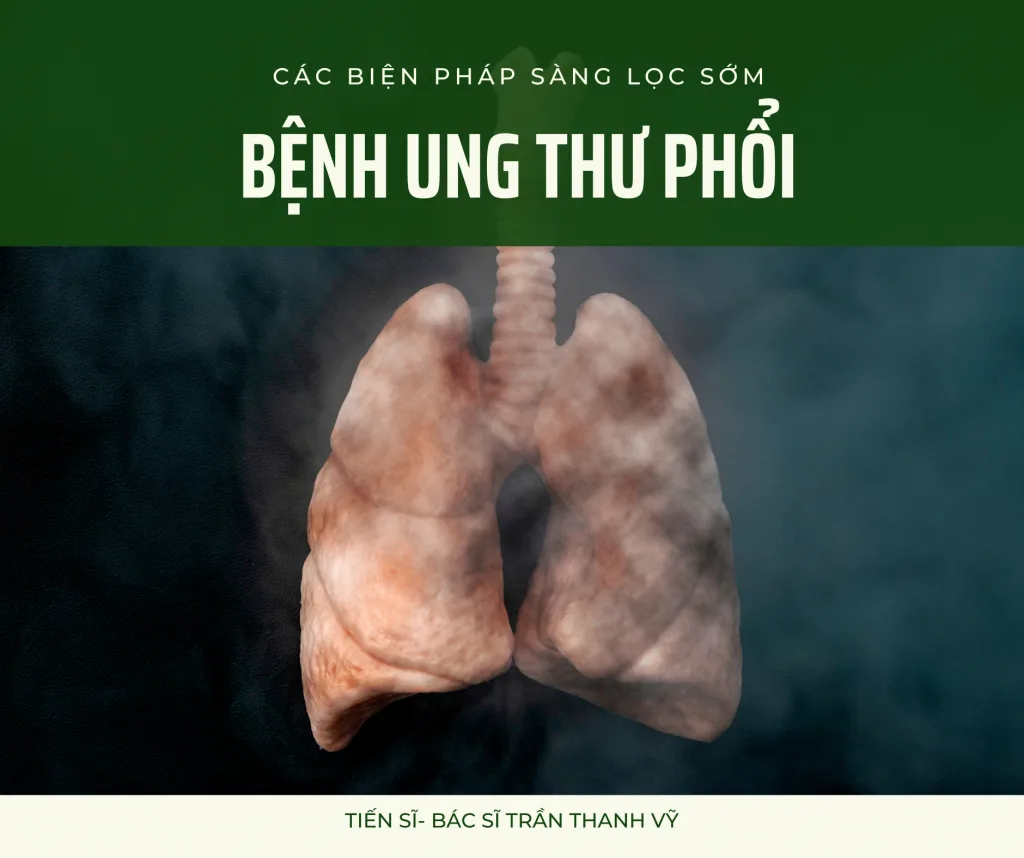 các biện pháp sàng lọc sớm