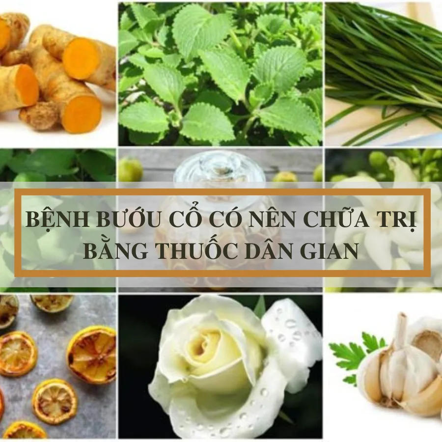Có nên điều trị bướu cổ tại nhà bằng phương pháp nhân gian?
